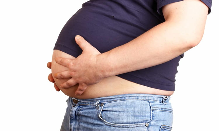मोटापा के लक्षण, कारण, इलाज और बचाव - Obesity Symptoms, Causes, Treatment and Prevention in Hindi