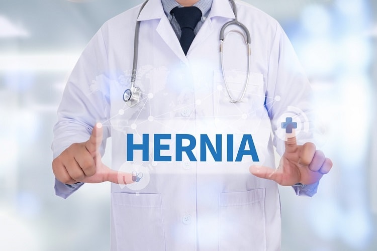 हर्निया के कारण लक्षण इलाज और परहेज – Hernia Cause Symptoms Treatment In Hindi