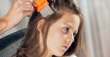 बालों से जूँ (लीख) निकालने के घरेलू उपाय - Home Remedies For Hair Lice in Hindi