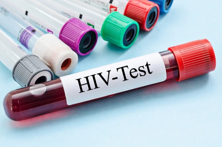 एचआईवी टेस्ट क्या है, प्रकार, प्रक्रिया - What Is HIV Test, Types, Procedure In Hindi