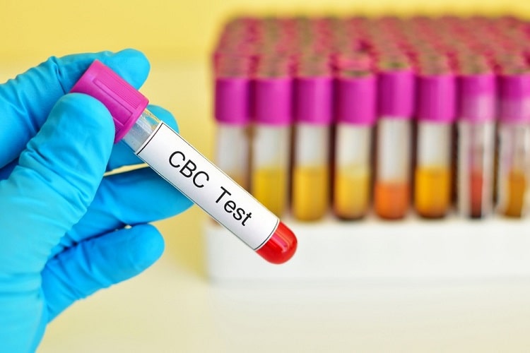 पूर्ण रक्त गणना (सीबीसी) क्या है, क्यों आवश्यक है, टेस्ट के परिणाम, सामान्य स्तर और कीमत - What is complete blood count (cbc) test, results, normal range and cost in Hindi
