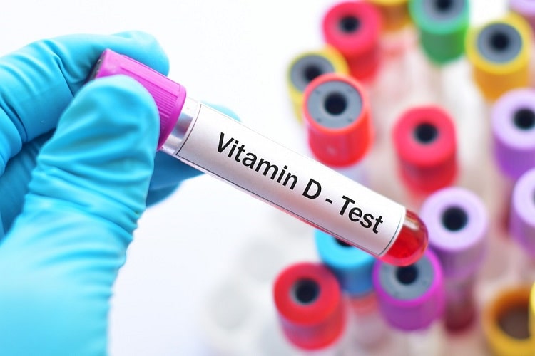 विटामिन डी टेस्ट क्या है, तैयारी, प्रक्रिया, परिणाम और कीमत – What is vitamin D Test in Hindi