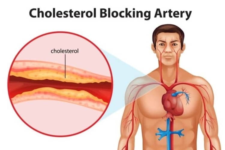 सौंफ के पानी के औषधीय गुण कोलेस्‍ट्रॉल कम करे – Fennel Water benefits to Reduce Cholesterol in Hindi