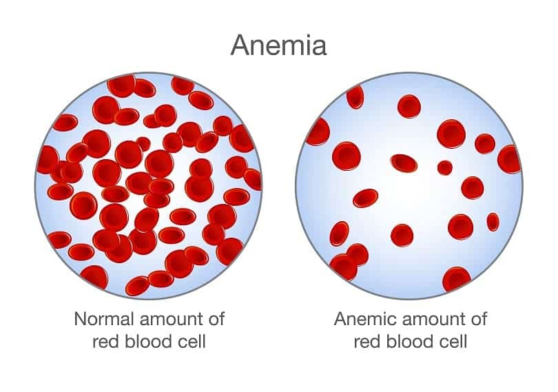 अनार का उपयोग खून की कमी को दूर करे – Pomegranate Prevents Anaemia in Hindi