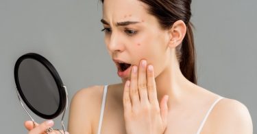 मुंहासे के लिए घरेलू उपचार - Home Remedies for Acne in Hindi