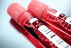 ब्लड टेस्ट (खून की जांच) क्या है, प्रकार, नाम, नार्मल रेंज और रिजल्ट - What Is Blood Test In Hindi