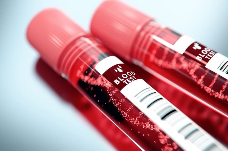 ब्लड टेस्ट (खून की जांच) क्या है, प्रकार, नाम, नार्मल रेंज और रिजल्ट - What Is Blood Test In Hindi