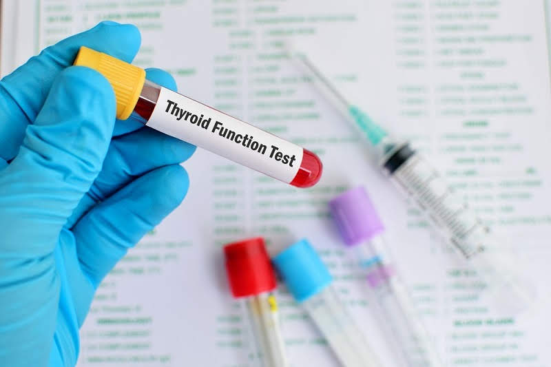 थाइरोइड फंक्शन टेस्ट की प्रक्रिया, प्रकार, रिजल्ट और कीमत – Thyroid Function Test Type, Result And Price In Hindi