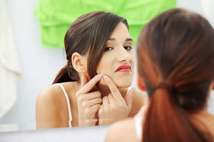 एक दिन में चेहरे से पिंपल्स को कैसे हटाएं - How To Remove Pimples From Face Naturally In One Day At Home In Hindi