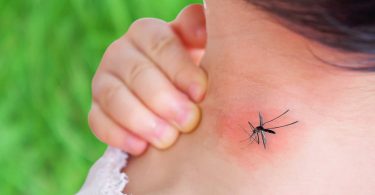 मच्छर के काटने के निशान कैसे मिटायें - Machar Katne Ke Nishan Kaise Mitaye