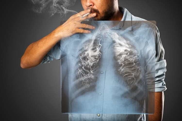 फेफड़ों को साफ रखने के लिए धूम्रपान न करे - Lungs Ko Saaf Rakhne Ke liye smoking na kare
