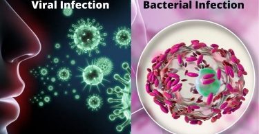 बैक्टीरियल और वायरल संक्रमण में क्या है अंतर - Difference Between Bacterial and Viral Infections in Hindi