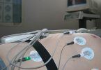 इलेक्ट्रोमायोग्राफी क्या है, कीमत, प्रक्रिया और ईएमजी टेस्ट रिजल्ट - Electromyography (EMG) test in Hindi